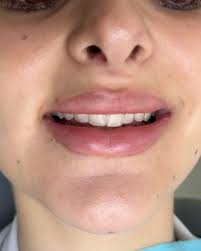 ابتسم دائما ❤️