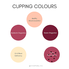 Kanpobliss Tcm Singapore Massage Therapy Cupping Therapy Tcm