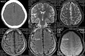 We did not find results for: Know About The Dicom Viewer Online That Are Available Free Viewers Create Diy Mac
