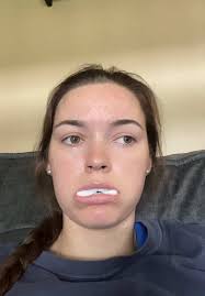 Dr Pickle Wisdom Teeth