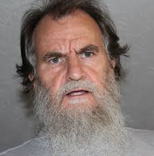 Garmin contact points for longer haired dogs