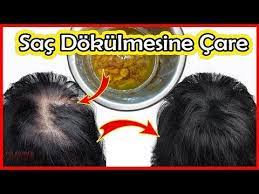 Sac Dokulmesine Care Mucize Sac Bakim Yagi Dokulen Saclari Cikartan Yag Sac Bakimi Youtube Sac Bakimi Sac Youtube
