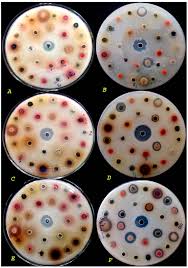 Image result for Sphaeranthus flexuosus