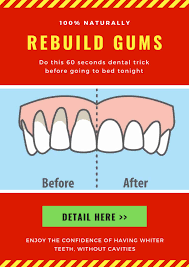 Laser gum rejuvenation also helps your gum tissues and pockets to heal successfully than other traditional methods. How To Stop Receding Gums From Getting Worse At Home By Purwantoo Issuu