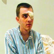 Stracił oko, będzie sąd