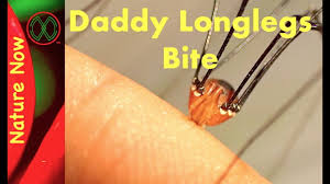 From my expirience with crickets (growing up with 2 brothers and playing with inocent little insects) they live about 5 minutes after starfish live in water but that doesn't mean that the water helps them grow there legs back. Quick Answer Can Daddy Long Legs Regrow Legs Black Lights