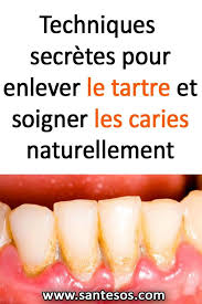 Pin On Astuces Sante