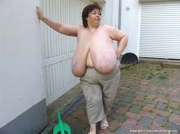 Tumbex Karola Siliconefree Gigant Free Nude Porn Photos 52305 | Hot Sex  Picture