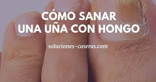 Hongos En Las Uñas De Las Manos Como Eliminarlos Tratamientos Eficaces Para Eliminar Hongos De Las Unas En 2020 Eliminar Hongos De Las Unas Tratamiento Para Hongos En Las Unas Hongos Unas Pies