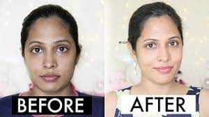 How To Remove Sun Tan From Your Face Quickly | Immediate Results - Youtube