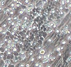 Cord blood in hematopeietic stem cell transplantation and beyond