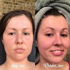 ODW vs Midnight Oil Serum One Drop Wonder Is one of our serums made with  Pomifera Oil. It helps with numerous skin conditions