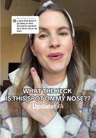 Why Do All Theses Girl Have A White Spot