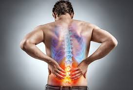 Image result for Sciatica