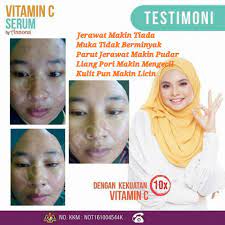Khasiat vitamin c serum annona. Serum Vitamin C Annona Menjadikan Wajah Flawless Jus Annona Khasiat Jus Durian Belanda Organik