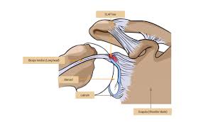 Image result for SLAP Lesion