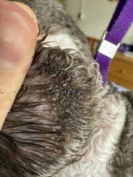 Image result for what do lice look like in dog fur
