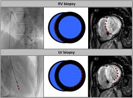 Vivir en mi casa inn es una experiencia inolvidable. Diagnosis And Treatment Of Cardiac Amyloidosis Position Statement Of The German Cardiac Society Dgk Springerlink