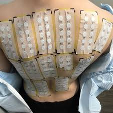 Image result for Patch Testing