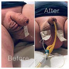 Scrotal Infusion • Medical Dominatrix London • Madame Li Ying