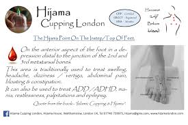Hijama Feet Points Hijama Cupping London