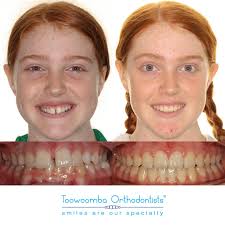 Toowoomba Orthodontists