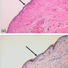 This database of images, including all the routes . Normal Mesothelium Histological Features A Haematoxylin And Eosin Download Scientific Diagram