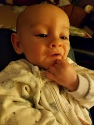 Our 4 month old son recently went through head surgery doctors say it's  just the start he will be getting 3 more 🥺 Since he was born he started  having a lot