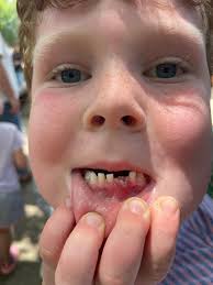 Kendall competition vote verification update