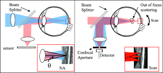 Quantum illumination is a paradigm for target detection that employs quantum entanglement between a signal electromagnetic mode and an idler electromagnetic mode, as well as joint measurement of these modes. A Schematic Comparison Of Flood Illuminated And Scanning Confocal Download Scientific Diagram