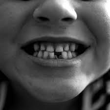 My Little Girl Lost Her First Tooth Little Girl Lost Teeth First Tooth