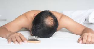 Anda boleh pilih untuk menerima rawatan seperti yun nam hair care untuk menumbuh kembali akar rambut anda selepas keguguran. 7 Syampu Terbaik Untuk Rambut Gugur Dari Drugstore Di Malaysia 2021