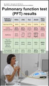 Image result for Pulmonary Function Test