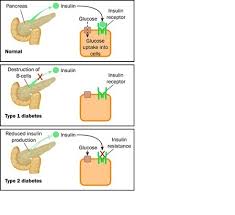 Ce trebuie sa faca pentru ca sa ii scada? Cat Este Glicemia Normala Recomandari Pentru 2020 Ehealth Romania