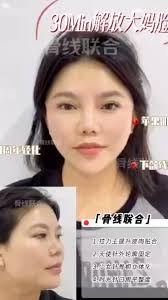 只有衰老是轻而易举的！, 但凡你看到的美女都是偷吃了“防腐剂”, #骨线联合 #全脸提升 #幼态脸