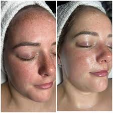 Beauty Valley Spa & Salon