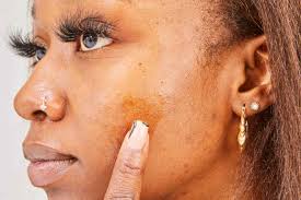 The 7 Best Dark Spot Correctors of 2025, Tested and Expert-Backed