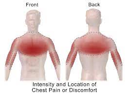 Chest Pain Wikipedia
