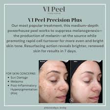 MOTHER'S DAY SPECIAL• Relax & Refresh Facial for Mom- $100 • This facial  will include: •Full 60-minute customized facial tailored to Mom's specific  skin type. •Double Cleanse. •Full Skin Analysis. •Exfoliation. •Extractions  (