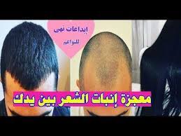 معجزة ربانية تنبت شعرك و الصلع وأقسم بالله النتيجة ستبهرك تنبت الشعر وتملأ الفراغات تجربتي youtube grow hair hair impo