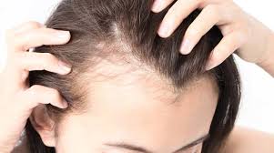 So, if you are worried about how to style baby hair, you are in the right place! How To Get Rid Of Baby Hairs On Forehead Hairline And Body Hair Mag