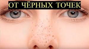 как убрать черные точки на носу в домашних условиях Chernye Tochki Chernye Tochki Na Nosu Chernye Tochki Na Lice Kak Ubrat Chernye Tochki Chyornye Tochki Chyornye Tochki Na Lice Ch V 2020 G Naturalnye Maski Dlya Lica Chernye Tochki Lico