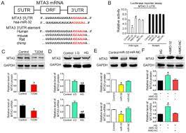 Hg384 women hair jewelry rhinestones tiaras flower crown. High Glucose Promotes Hepatic Fibrosis Via Mir 32 Mta3 Mediated Epithelial To Mesenchymal Transition