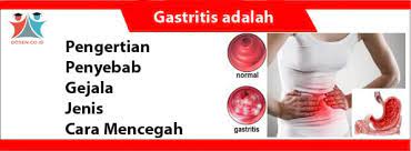 Megha r., farooq u., lopez p. Gastritis Adalah Pengertian Penyebab Jenis Cara Mencegah