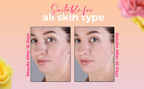 SUROSKIE Rosanna Rose Instant Glow Face Mask 50ml