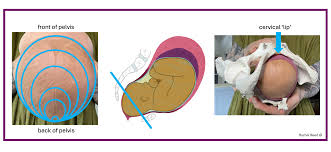 Image result for Lip Exam