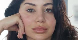 MAFS' Martha Kalifatidis discusses pregnancy side effects