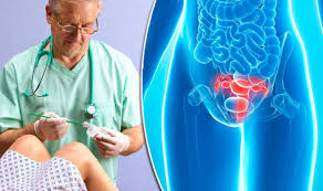 Tue, jan 26, 2016, 03:31 updated: Cervical Cancer Symptoms Woman Said Abnormal Bleeding Was A Sign Express Co Uk
