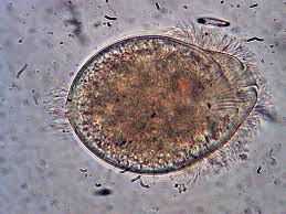 Image result for Balantoides Coli