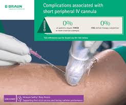 Image result for Difficult Intravenous Access in Children